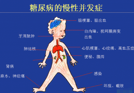 你還在害怕糖尿病嗎？科學補硒不“恐糖”