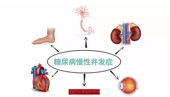 血糖波動大，并發(fā)癥來得快，糖友要多補硒